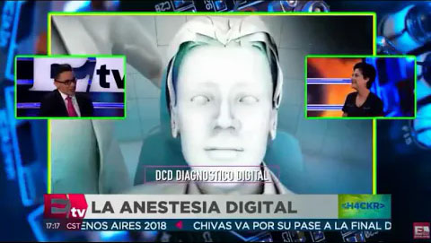 Anestesia Digital en Excelsior TV | La Cl&iacute;nica Dental