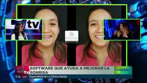 Dise&ntilde;o de Sonrisa en Excelsior TV | La Cl&iacute;nica Dental